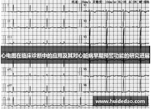 心电图在临床诊断中的应用及其对心脏病早期预警功能的研究进展